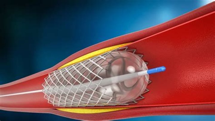 Angela Stent Net Worth