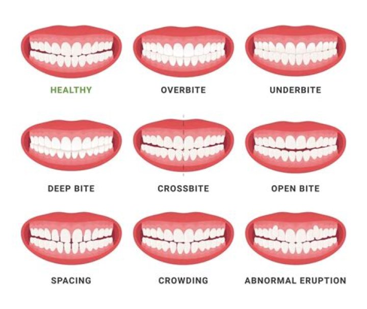 CeeDee Lamb Has The Perfect Teeth: Did He Wear Braces? Dental Procedures Explained