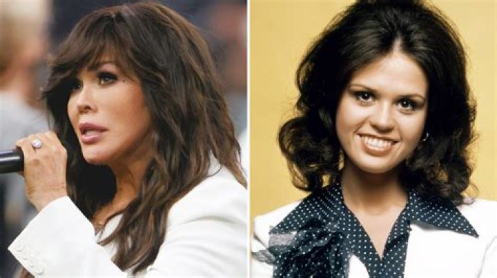 Does Marie Osmond Wear A Wig? Her Natural Hair And Hairstyles