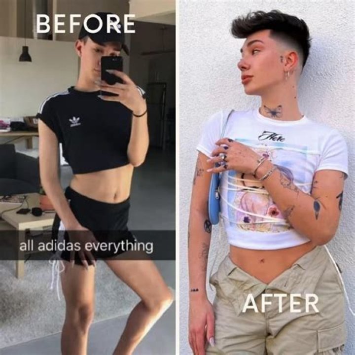 Ella Bands Before Surgery: Did She Have BBL?