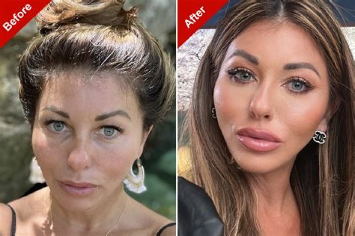 “FoodGod” aka Jonathan Cheban Face Before Surgery And Does He Have A Glass Eye? Rumors Explored