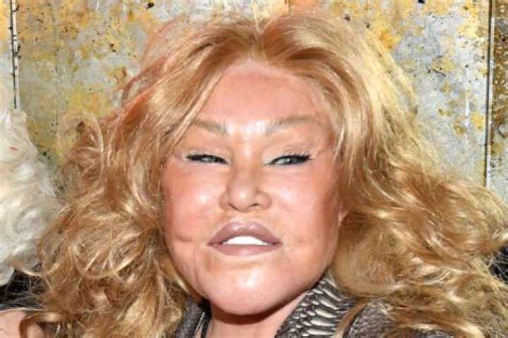 Jocelyn Wildenstein Net Worth