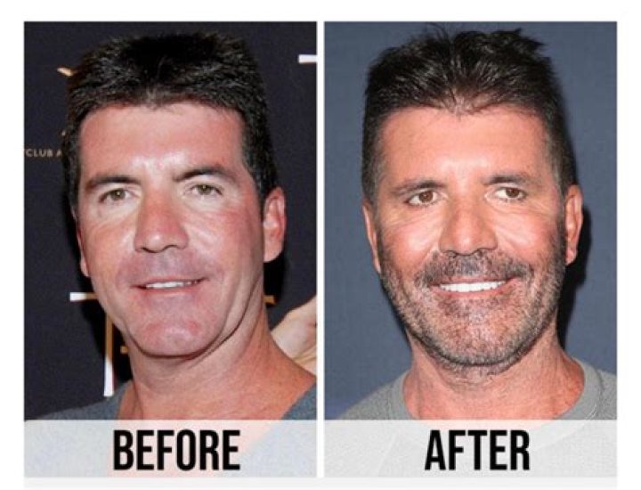 Josh Popper Plastic Surgery: Has He Had Cosmetic Surgery?
