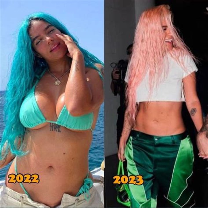 Karol G BBL: Before And After Photos
