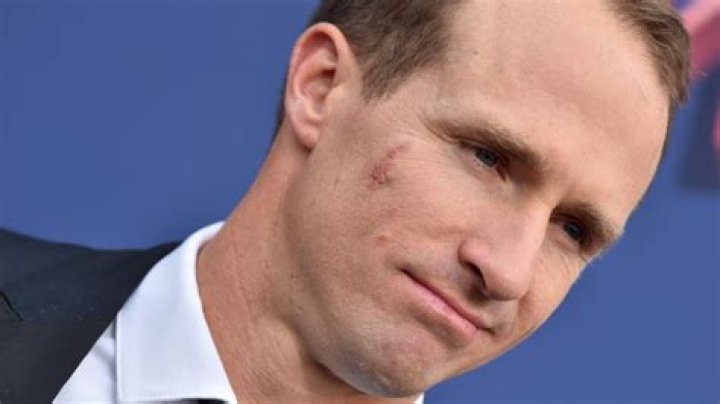 
NBC Commentator Drew Brees Face Scar Is Coming Up Again As Fans Wonder What Happened 