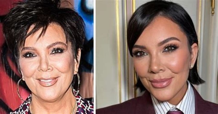 
What Happened To Yasmin Vossoughian’s Face – Did She Get A Face Lift? 