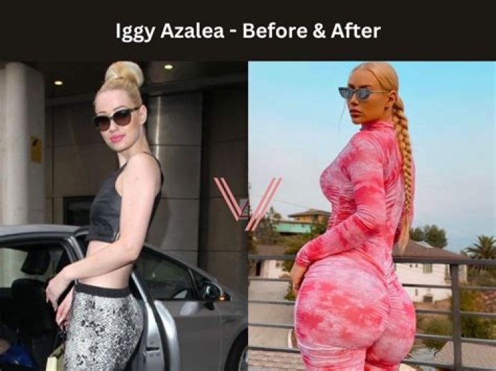 Who Is Iggy Azalea’s Husband Now And Whats Her Net Worth In 2022?